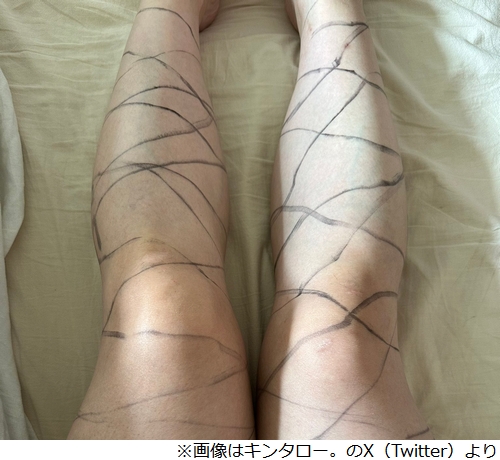 ニュース画像
