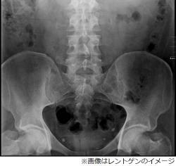 手術で 健康な睾丸 を誤摘出 父親になれない と病院を提訴 Narinari Com 手術で 健康な睾丸 を誤摘出 父親になれない と病院を提訴 Narinari Com